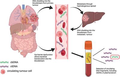 Circulating Bacterial DNA: A New Paradigm for <mark class="highlighted">Cancer</mark> Diagnostics